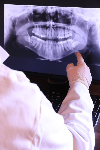 Best Emergency Root Canal Treatment in Monticello, IL
