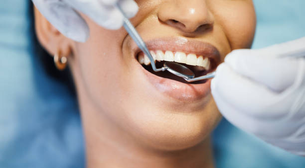 Best After-Hours Emergency Dentist in Monticello, IL