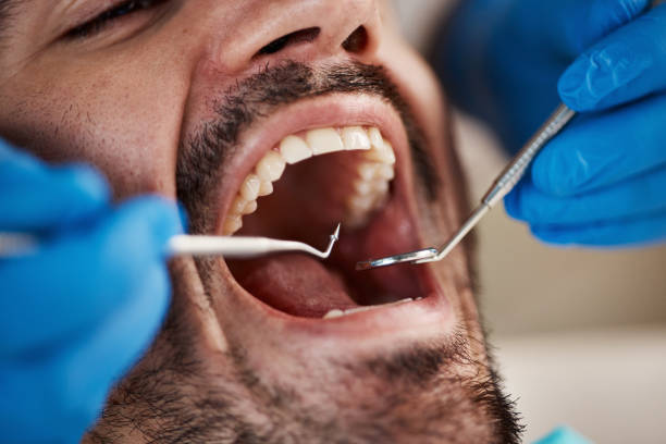 Best Emergency Treatment for Toothache in Monticello, IL